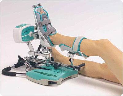 Kinetec Breva Ankle CPM